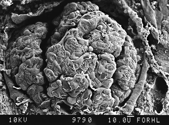 Photo: a scanning electron microscope image of a glomerulus.